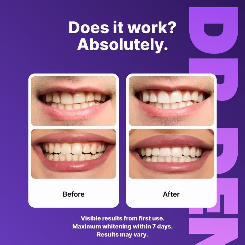 Achieve a Dazzling Smile with DR.DENT Purple Teeth Whitening Strips - 7 or 21 Sessions of Enamel-Safe, Peroxide-Free Whitening for Sensitive Teeth